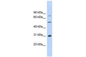 Image no. 1 for anti-Aspartate beta-Hydroxylase (ASPH) (AA 287-336) antibody (ABIN6744502) (Aspartate beta Hydroxylase antibody  (AA 287-336))