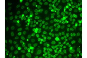 Immunofluorescence analysis of HeLa cells using LMNB1 antibody (ABIN5970980).
