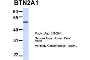 Host:  Rabbit  Target Name:  BTN2A1  Sample Type:  Human Fetal Heart  Antibody Dilution:  1. (BTN2A1 antibody  (N-Term))
