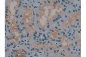 Detection of REN in Human Kidney Tissue using Polyclonal Antibody to Renin (REN) (Renin antibody  (AA 67-153))