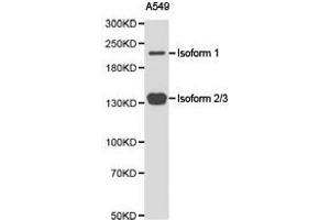 Western Blotting (WB) image for anti-Tet Methylcytosine Dioxygenase 2 (TET2) antibody (ABIN1875061) (TET2 antibody)