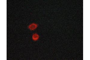 Immunofluorescence (fixed cells) (IF/ICC) image for anti-Nuclear Factor of kappa Light Polypeptide Gene Enhancer in B-Cells Inhibitor, alpha (NFKBIA) (pSer32), (pSer36) antibody (ABIN6256292)