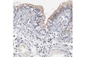 Immunohistochemical staining (Formalin-fixed paraffin-embedded sections) of human bronchus with DNAL4 polyclonal antibody  shows moderate positivity in cilia of respiratory epithelial cells.