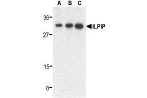 Western blot analysis of ILPIP in human heart lysate with AP30432PU-N ILPIP antibody at 0. (STRADB antibody  (C-Term))