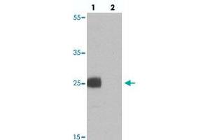 Western blot analysis of EMX1 in rat liver tissue with EMX1 polyclonal antibody  at 1 ug/mL in (lane 1) the absence and (lane 2) the presence of blocking peptide. (EMX1 antibody  (N-Term))