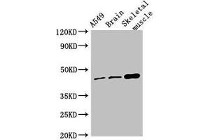 Western Blot Positive WB detected in: A549 whole cell lysate, Mouse brain tissue, Mouse skeletal muscle tissue All lanes: TMEM43 antibody at 4 μg/mL Secondary Goat polyclonal to rabbit IgG at 1/50000 dilution Predicted band size: 45 kDa Observed band size: 45 kDa (TMEM43 antibody  (AA 178-312))