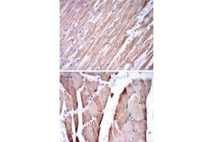 Immunohistochemical analysis of paraffin-embedded human cardiac muscle tissue (A) and striated muscle tissue (B) using TNNI2 monoclonal antobody, clone 2F12A8  with DAB staining.
