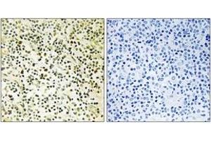 Immunohistochemistry (IHC) image for anti-Nucleophosmin (Nucleolar phosphoprotein B23, Numatrin) (NPM1) (AA 201-250) antibody (ABIN1532749)