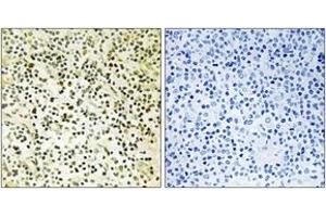 Immunohistochemistry analysis of paraffin-embedded human tonsil tissue, using NPM (Ab-234) Antibody. (NPM1 antibody  (AA 201-250))