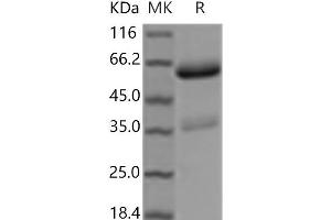 Western Blotting (WB) image for Tumor Necrosis Factor Receptor Superfamily, Member 11a, NFKB Activator (TNFRSF11A) protein (Fc Tag) (ABIN7198423) (TNFRSF11A Protein (Fc Tag))
