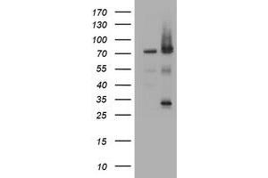 Image no. 1 for anti-Receptor (TNFRSF)-Interacting serine-threonine Kinase 1 (RIPK1) (AA 133-422) antibody (ABIN1490912) (RIPK1 antibody  (AA 133-422))