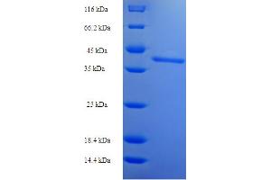 SDS-PAGE (SDS) image for Synovial Sarcoma, X Breakpoint 2 (SSX2) (AA 1-188), (full length) protein (His-SUMO Tag) (ABIN5711253)