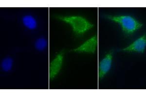 Detection of AIF in Human Hela cell using Polyclonal Antibody to Apoptosis Inducing Factor (AIF) (AIF antibody  (AA 103-322))