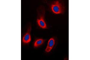 Immunofluorescent analysis of Caspase 3 staining in HeLa cells. (Caspase 3 antibody  (Center))