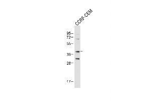 Anti-Mouse Nkx2-5 Antibody (Center) at 1:1000 dilution + CCRF-CEM whole cell lysate Lysates/proteins at 20 μg per lane. (NK2 Homeobox 5 antibody  (AA 98-133))