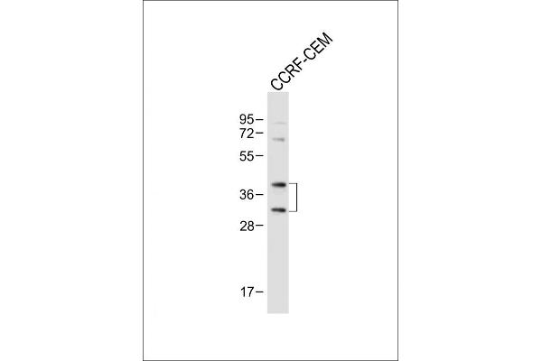 NK2 Homeobox 5 antibody  (AA 98-133)