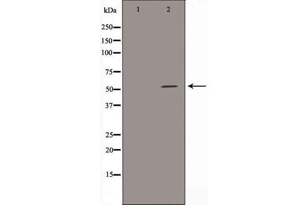 ALDH3B1 antibody  (N-Term)