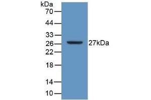 Detection of Recombinant ATP1b3, Human using Polyclonal Antibody to Sodium/potassium Transporting ATPase Subunit Beta-3 (ATP1b3) (ATP1B3 antibody  (AA 61-273))