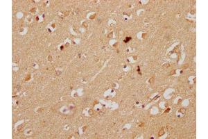 IHC image of ABIN7157259 diluted at 1:200 and staining in paraffin-embedded human brain tissue performed on a Leica BondTM system. (KBTBD7 antibody  (AA 475-684))