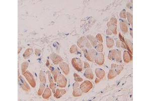 Used in DAB staining on fromalin fixed paraffin- embedded skin tissue (GSTT1 antibody  (AA 7-231))