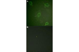 Immunofluorescent staining of methanol-fixed Hela cells using APP (phospho T743/668) polyclonal antibody  at 1:100-1:200 dilution. (APP antibody  (pThr668, pThr743))