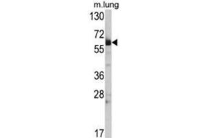 Western blot analysis of Hsp 60 Antibody (N-term) in mouse lung tissue lysates (35ug/lane). (HSPD1 antibody  (N-Term))