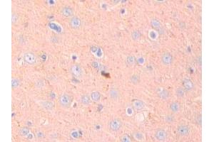 Used in DAB staining on fromalin fixed paraffin- embedded kidney tissue (ADAM10 antibody  (AA 218-445))