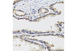 Immunohistochemistry of paraffin-embedded human prostate using PLA2G7 antibody. (PLA2G7 antibody)
