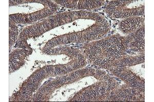 Image no. 5 for anti-Mitogen-Activated Protein Kinase Kinase 1 (MAP2K1) antibody (ABIN1499394) (MEK1 antibody)