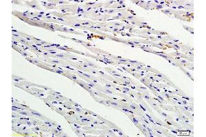 Formalin-fixed and paraffin embedded rat myocardium tissue labeled with Anti- PDGF-BB Polyclonal Antibody, Unconjugated (ABIN674874) followed by conjugation to the secondary antibody and DAB staining