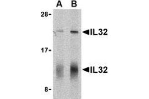 Western blot analysis of IL-32 in human spleen cell lysate with AP30424PU-N IL-32 antibody at (A) 5 and (B) 10 μg/ml shows two isoforms of IL-32. (IL32 antibody  (C-Term))