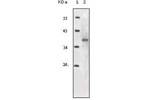 Western blot analysis using IGF1R mouse mAb against truncated IGF1R recombinant protein. (IGF1R antibody)
