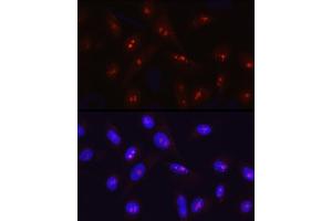 Immunofluorescence analysis of U2OS cells using SIRT7 Rabbit pAb (ABIN3021210, ABIN3021211, ABIN3021212 and ABIN6214068) at dilution of 1:50 (40x lens). (SIRT7 antibody  (AA 201-400))