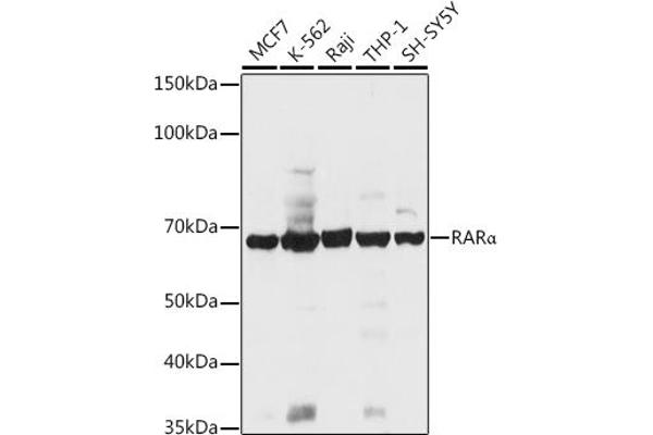 Retinoic Acid Receptor alpha antibody  (AA 1-457)