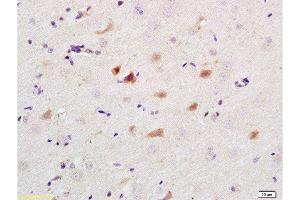 Immunohistochemistry (Paraffin-embedded Sections) (IHC (p)) image for anti-Caspase 9, Apoptosis-Related Cysteine Peptidase (CASP9) (AA 11-120) antibody (ABIN724160)