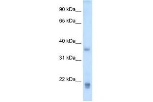 WB Suggested Anti-GH2 Antibody Titration:  5. (Growth Hormone 2 antibody  (Middle Region))