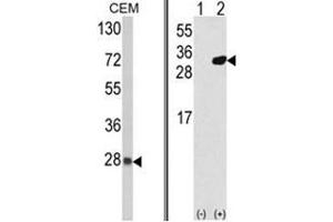 (LEFT) Western blot analysis of PRDX6 Antibody (C-term) in CEM cell line lysates (35ug/lane). (Peroxiredoxin 6 antibody  (C-Term))