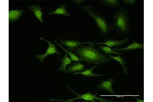 Immunofluorescence of purified MaxPab antibody to GIT2 on HeLa cell. (GIT2 antibody  (AA 1-471))