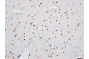 Formalin-fixed and paraffin embedded rat brain labeled with Rabbit Anti-SOX10 Polyclonal Antibody, Unconjugated (ABIN1386776) at 1:200 followed by conjugation to the secondary antibody and DAB staining (SOX10 antibody)