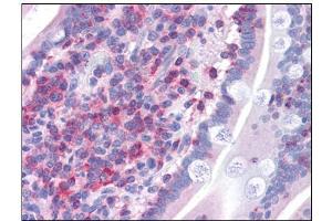 Human Small Intestine: Formalin-Fixed, Paraffin-Embedded (FFPE) (FNBP1 antibody  (Internal Region))