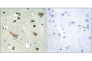 Immunohistochemistry analysis of paraffin-embedded human brain tissue, using 14-3-3 gamma Antibody. (14-3-3 gamma antibody  (AA 51-100))