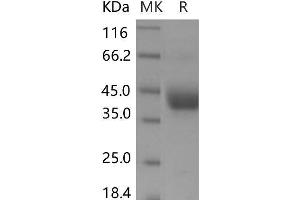 Western Blotting (WB) image for ADP-Ribosyltransferase 4 (Dombrock Blood Group) (ART4) protein (His tag) (ABIN7320048) (ART4 Protein (His tag))