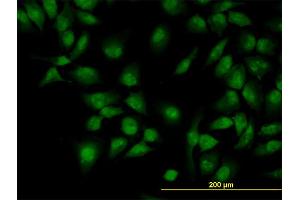 Immunofluorescence of monoclonal antibody to CLK3 on HeLa cell.