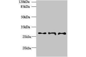 Western blot All lanes: BARX1 antibody at 6 μg/mL Lane 1: Hela whole cell lysate Lane 2: Jurkat whole cell lysate Lane 3: CEM whole cell lysate Secondary Goat polyclonal to rabbit IgG at 1/10000 dilution Predicted band size: 28, 12 kDa Observed band size: 28 kDa