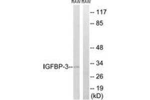 Western blot analysis of extracts from RAW246. (IGFBP3 antibody  (AA 151-200))