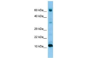 WB Suggested Anti-FABP9 Antibody Titration: 1. (FABP9 antibody  (Middle Region))