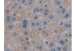 Detection of PDL1 in Mouse Liver Tissue using Polyclonal Antibody to Programmed Cell Death Protein 1 Ligand 1 (PDL1) (PD-L1 antibody  (AA 48-290))