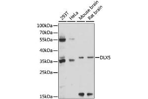 Western blot analysis of extracts of various cell lines, using DLX5 antibody. (DLX5 antibody)