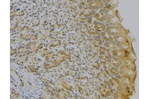 ABIN6277150 at 1/100 staining Human gastric tissue by IHC-P. (HLA-DQA1 antibody)