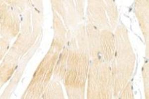 Immunohistochemistry (Paraffin-embedded Sections) (IHC (p)) image for anti-alpha-Actinin Skeletal Muscle (ACTN) antibody (ABIN7073023)